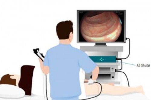 生6个月「废功」20%癌症检出率!pg电子中国柳叶刀惊曝:AI让医(图9) 生6个月「废功」20%癌症检出率!pg电子中国柳叶刀惊曝:AI让医(图9)