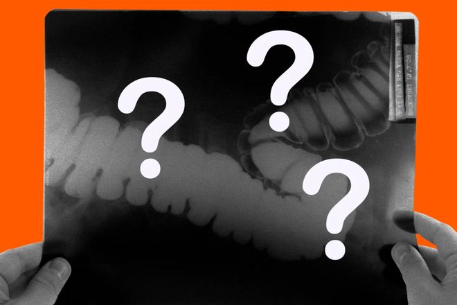 生6个月「废功」20%癌症检出率!pg电子中国柳叶刀惊曝:AI让医(图11) 生6个月「废功」20%癌症检出率!pg电子中国柳叶刀惊曝:AI让医(图11)